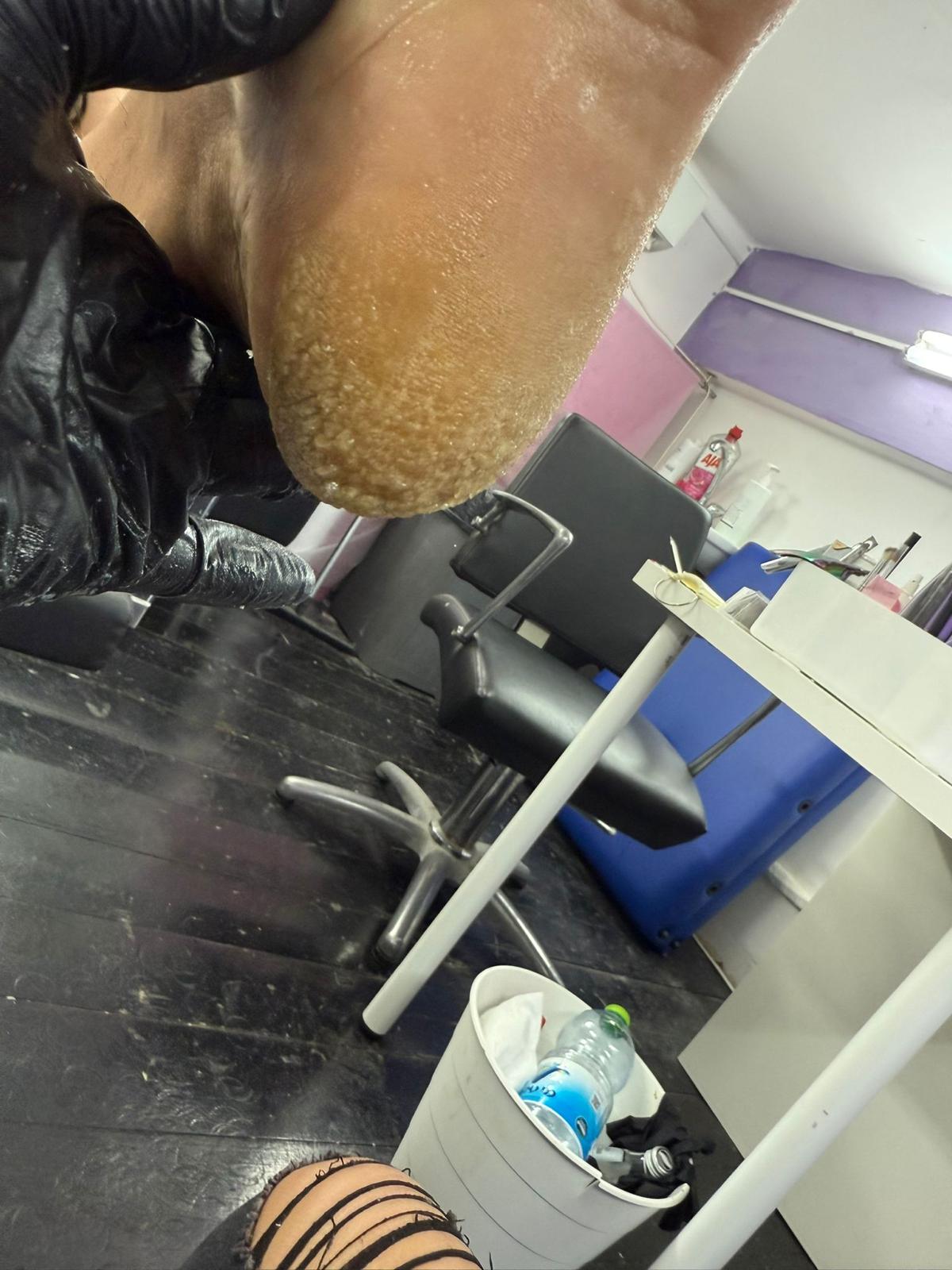 פדיקור רפואי